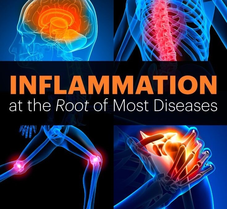 Inflammation and you!